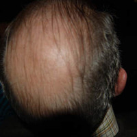 xdz4_arg/xdz4_arg/xdz4_arg_d/xdz4_arg_d426/xdz4_arg_d426_3. kanporaketa/xdz4_arg_d426_3.kanporaketa_3.kanporaketia 043.jpg